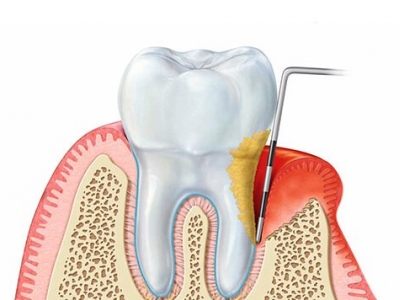 Periodontology